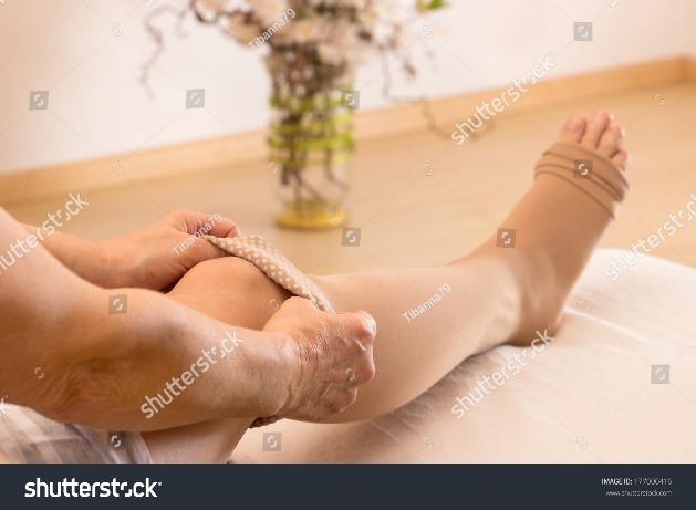 C:\Users\sue\Downloads\stock-photo-female-puts-some-anti-thrombotic-stockings-on-177000416.jpg