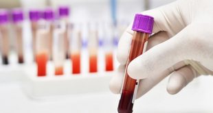 Blood test tube shortage: what nurses need to know