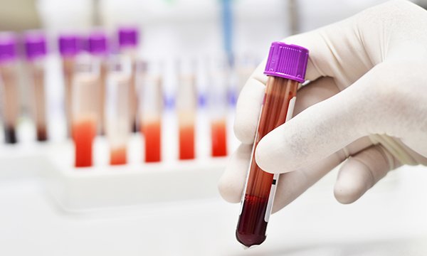 Can Nurses Order Lab Tests Nursing Trends