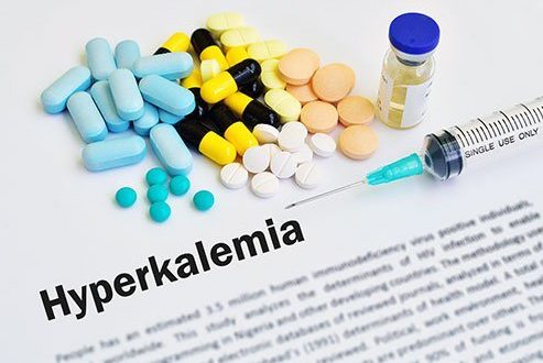 High Potassium (Hyperkalemia): Symptoms, Causes, Diet &amp; Treatment